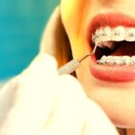Britany Marshall Beauty | Expert Skincare Tips, Makeup & Nail Tutorials 25 Most Popular Braces Colors to look more attrractive!