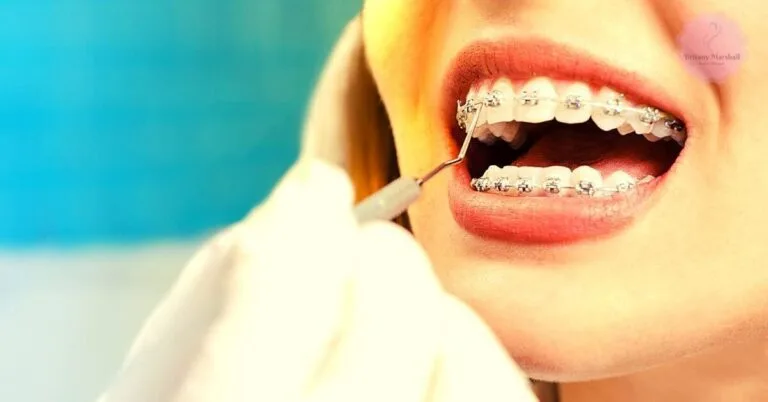a person with silver metallic braces undergoing dental cleaning by a professional using a dental tool