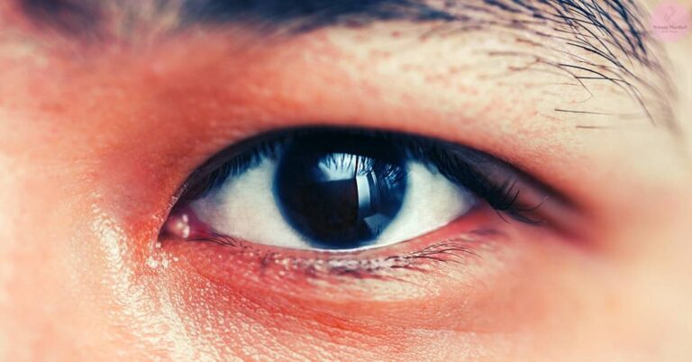 a close-up of a human monolid eye with visible fine skin texture and subtle redness around the eyelid