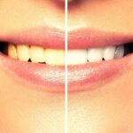 Britany Marshall Beauty | Expert Skincare Tips, Makeup & Nail Tutorials 23 10+ Ways How To Get Rid of Yellow Teeth & Stains!