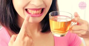 Why Are My Teeth Yellow? I Brush Them Everyday Twice!