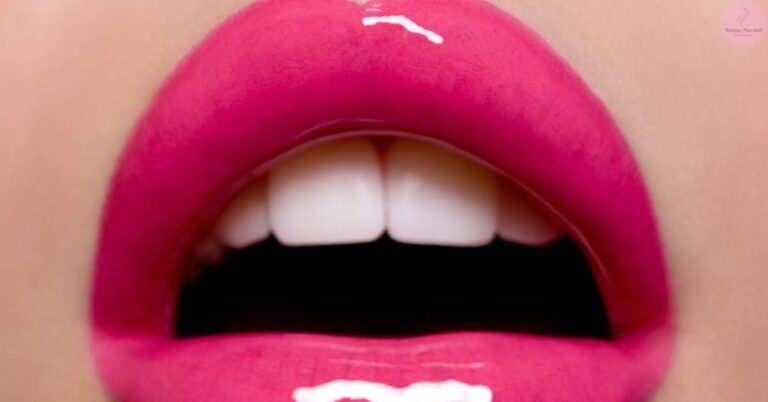 a close-up of exaggerated, pink-lip contours demonstrating a BOTOX lip flip effect with visible teeth and gum line.