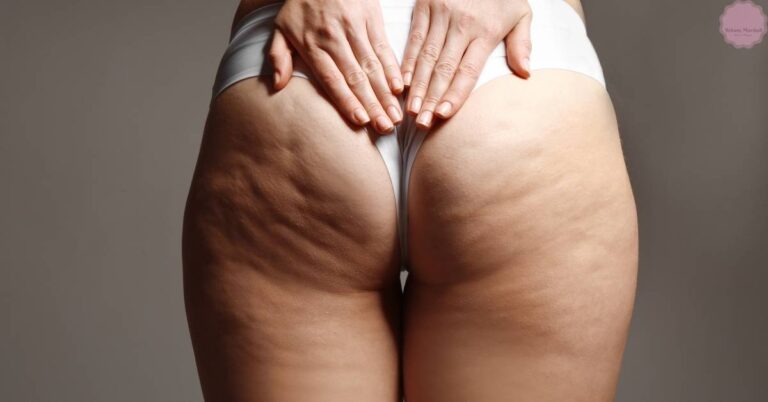 a person demonstrating the Gua Sha technique on thighs to improve skin texture and circulation
