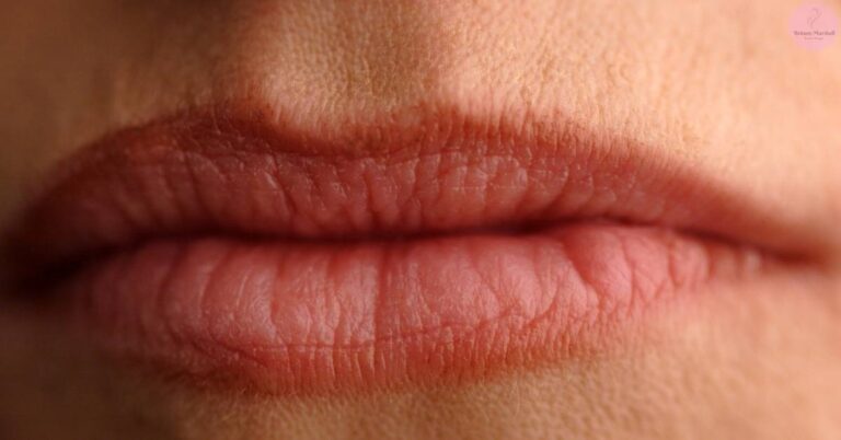 close-up of wrinkled, dry lips showing fine lines and loss of skin elasticity