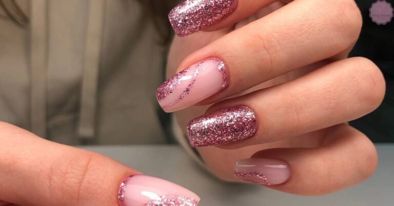 a close-up of hands showing peeling glitter gel polish on nails with uneven edges and chipped glitter particles.