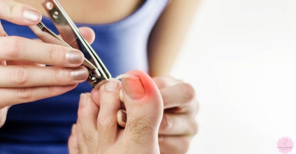 7 Ways How To Fix Ski Jump Toenails And Fingernails At Home!