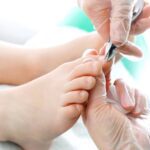7 Ways How To Fix Ski Jump Toenails And Fingernails At Home!