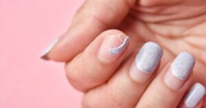 a damaged fingernail with peeling acrylic and exposed real nail showing signs of trauma and bleeding, highlighting nail repair needs.