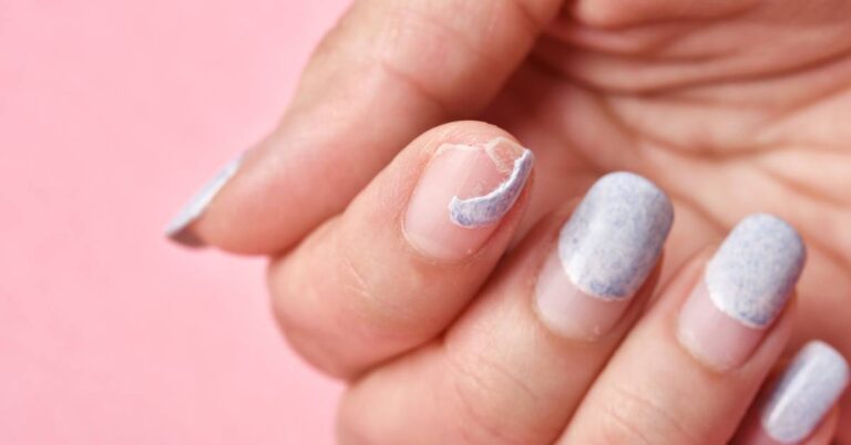 Acrylic Nail Ripped Off Real Nail: How To Speed Up Regrowth
