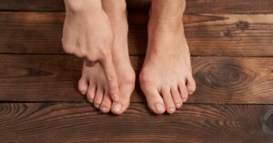 bare feet with toenails showing signs of natural wear and growth on a wooden surface