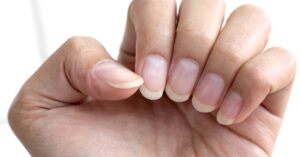 Home 1 a close-up of a hand showing naturally long fingernails on a man’s fingers