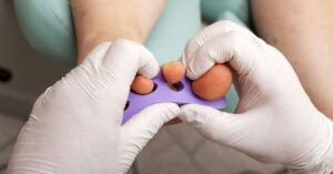 How To Easily Cut Fat Toenails At Home!