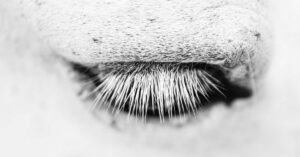 Is it Normal to Have One Long White Eyelash?
